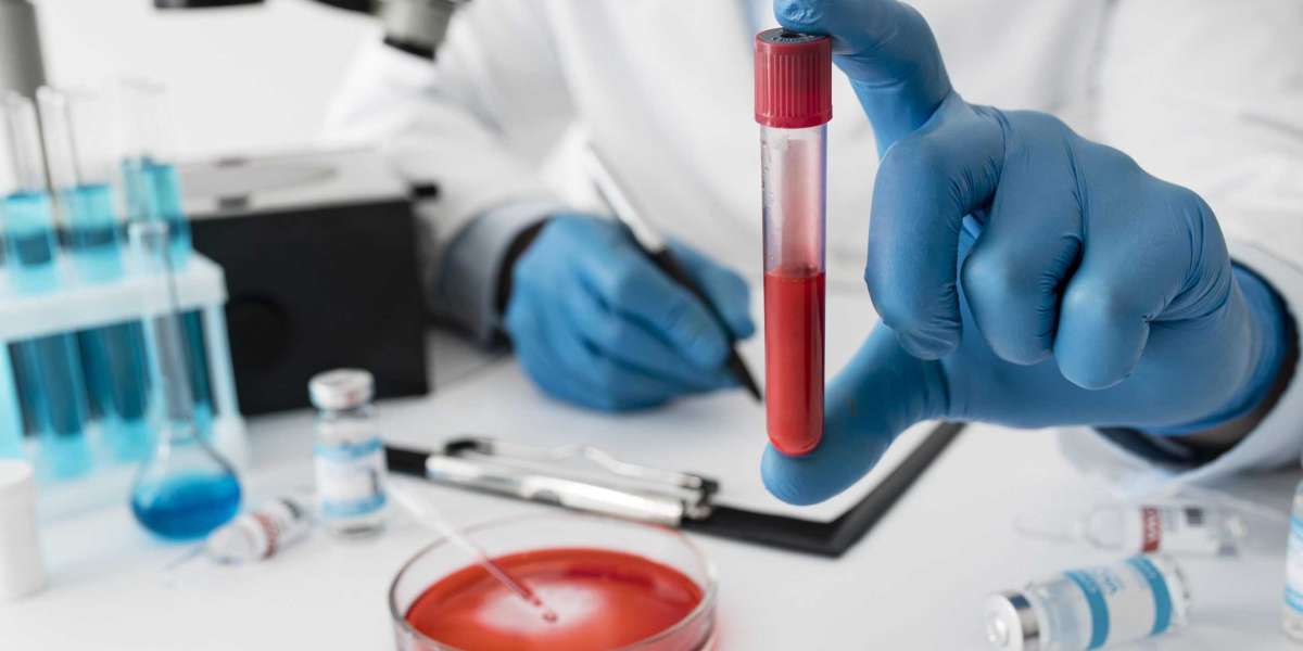 Your Health, Your Home: A Complete Guide to Hassle-Free Blood Tests in Bangalore