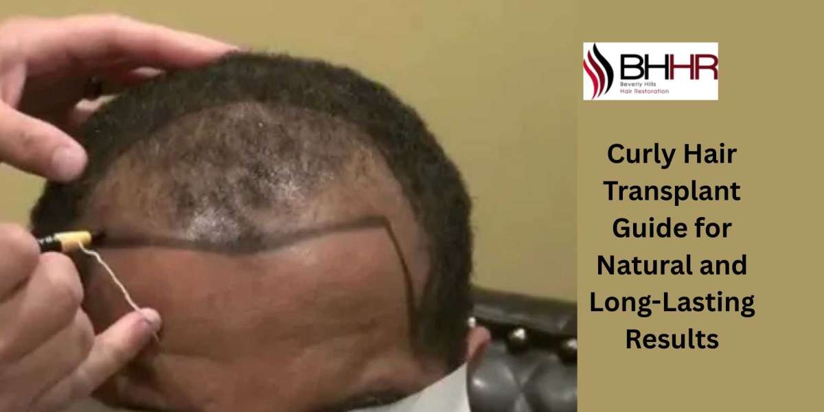 Curly Hair Transplant Guide for Natural and Long-Lasting Results