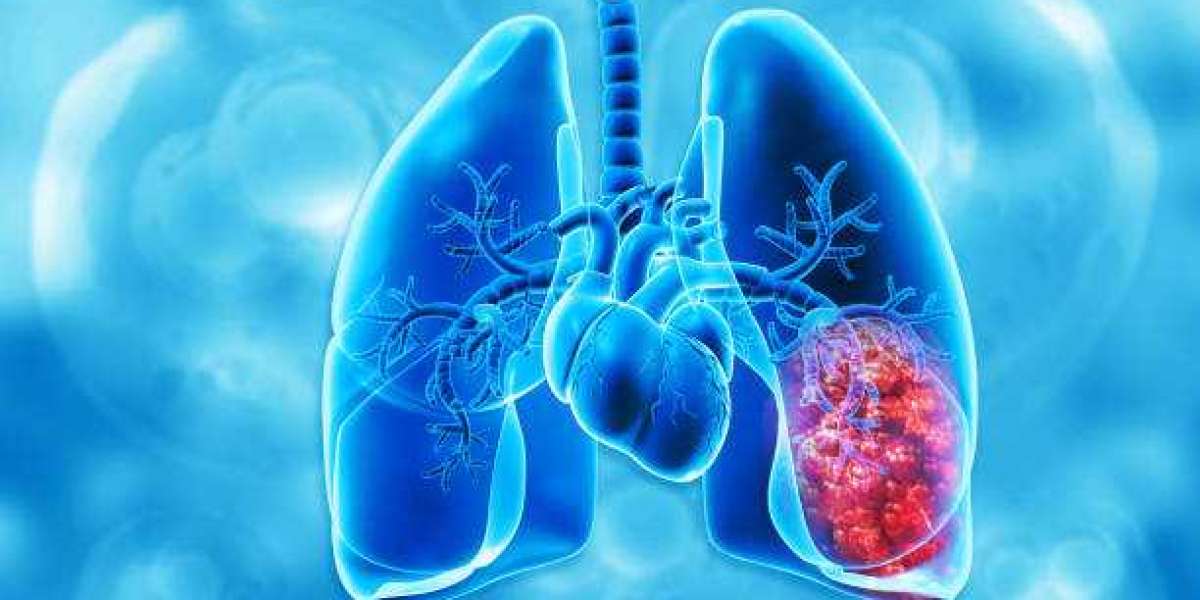 Comprehensive Guide to Cardiothoracic Surgery Services at Terna Hospital Navi Mumbai