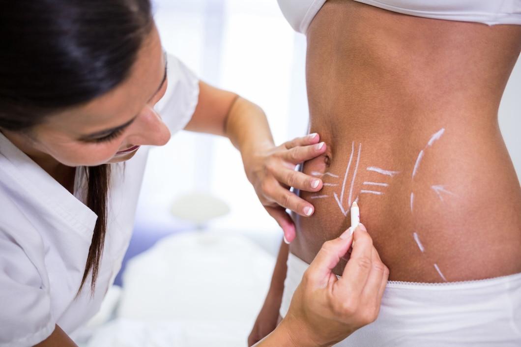 Top Non-Surgical Body Sculpting Treatments Explained - South County