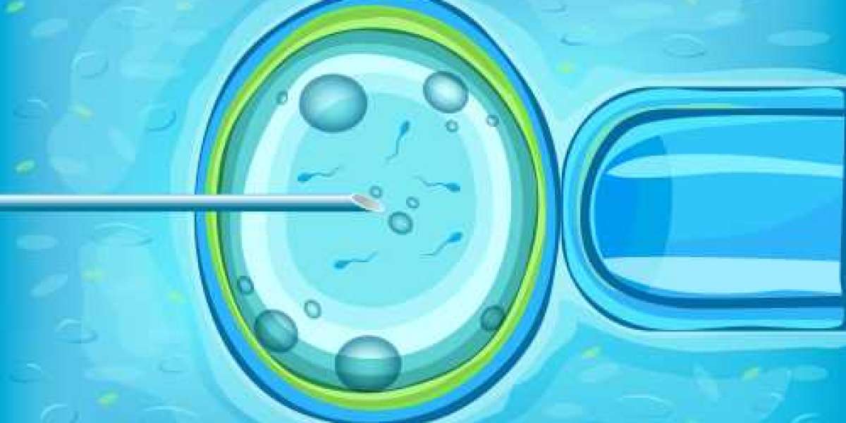 Frozen Embryo Transfer Treatment: Preparation, Procedure, and Recovery